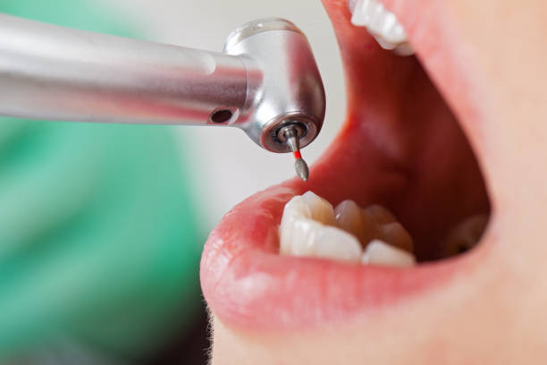 Best Pediatric Emergency Dentist in Elkland, PA